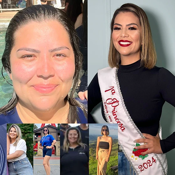 Depoimento cirurgia bariátrica